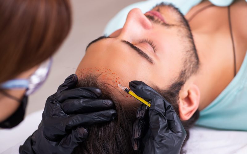 Young man visiting female beautician in hair transplantation con hair transplantation