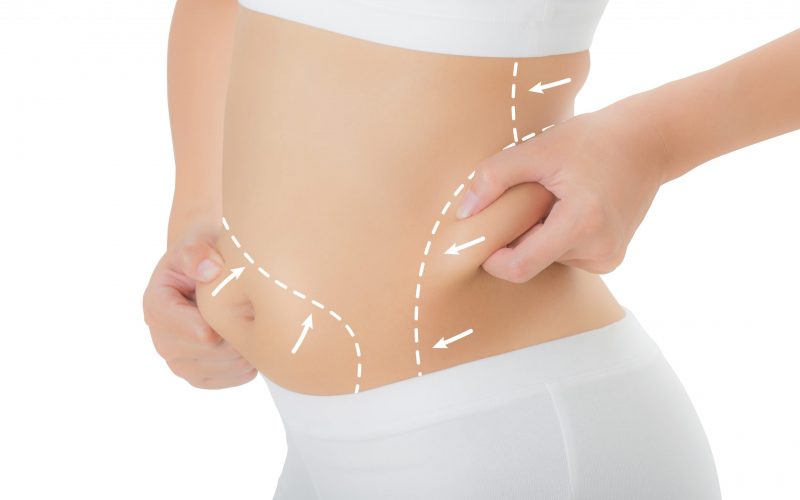 Close up woman grabbing skin on her hip and belly with the drawing arrows, Lose weight and liposuction cellulite removal concept, Isolated on white background. tummy-marking-lipo